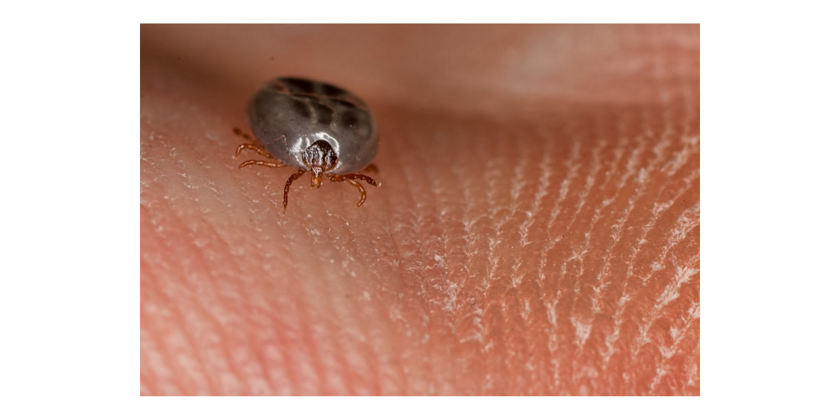 How deer ticks make you sick